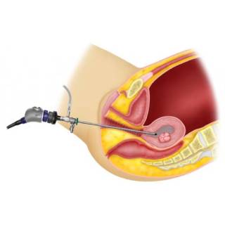 https://irepute.co.in/thangam-care/wp-content/uploads/2023/10/hysteroscopy-2.jpg