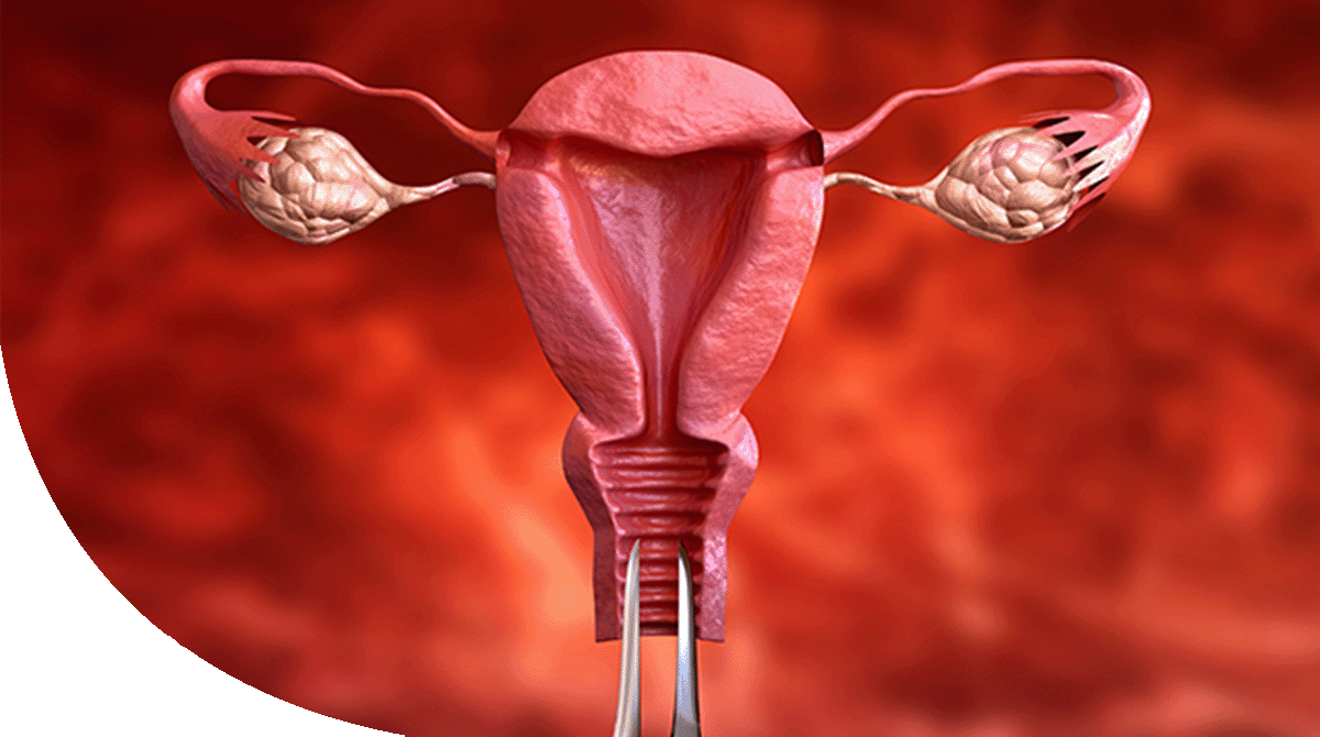 https://irepute.co.in/thangam-care/wp-content/uploads/2023/11/Endometrial-Cancer.png